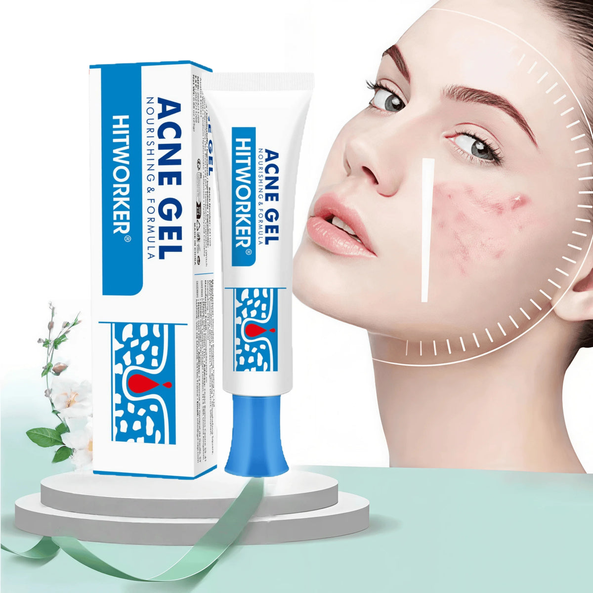 Acne Cream, Facial Scars, Blackhead Removal, Repair Gel, Oil Control, Pore Minimizing, Brightening Skincare