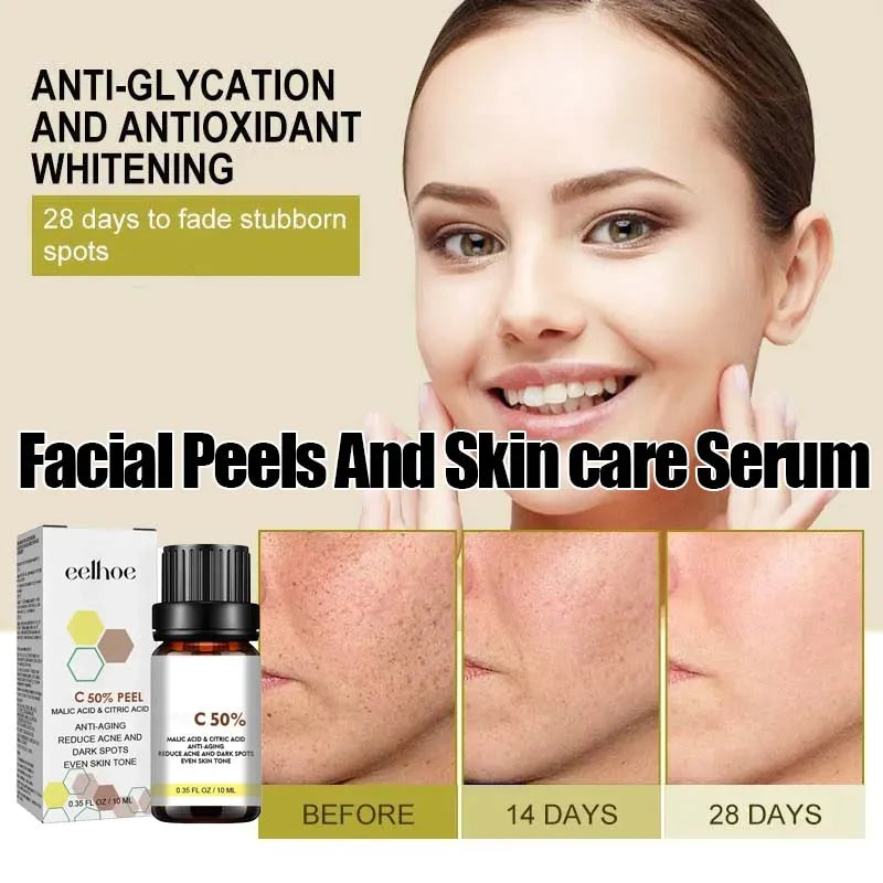 7ht With Malic Acid Citric Acid For Face Facial Peel 50% Peeling Serum Peeling Serum Chemical Peel Whitening Nourishing Essence