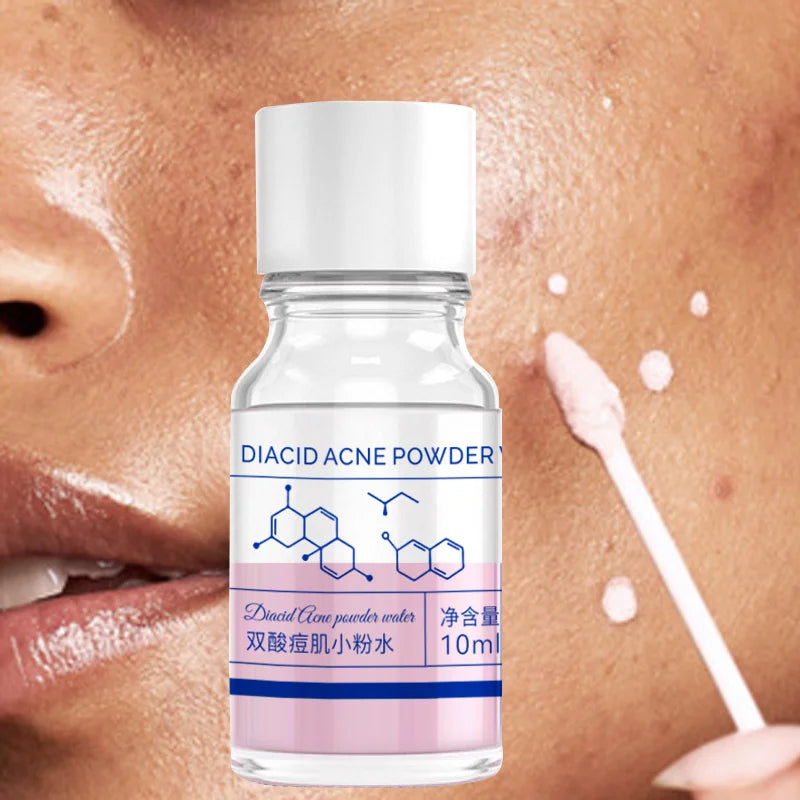 10ml Pink Salicylic Acid Concentrated Acne Essence - Containing Salicylic Acid, Lactose Acid, Calamine, Double Acid Dual Care
