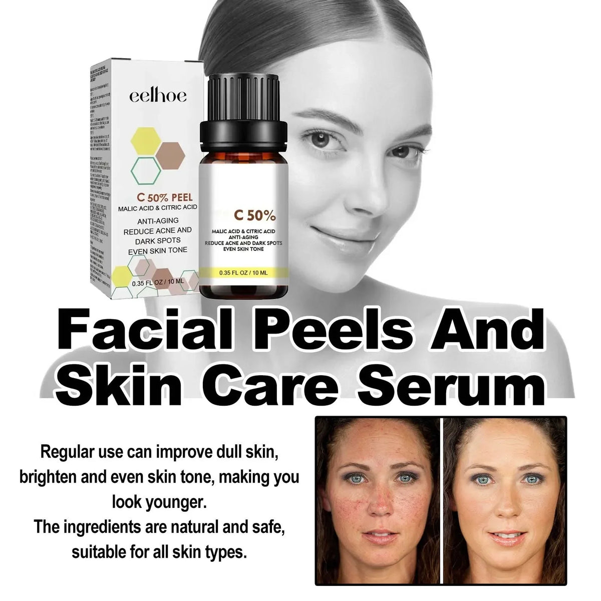 7ht With Malic Acid Citric Acid For Face Facial Peel 50% Peeling Serum Peeling Serum Chemical Peel Whitening Nourishing Essence