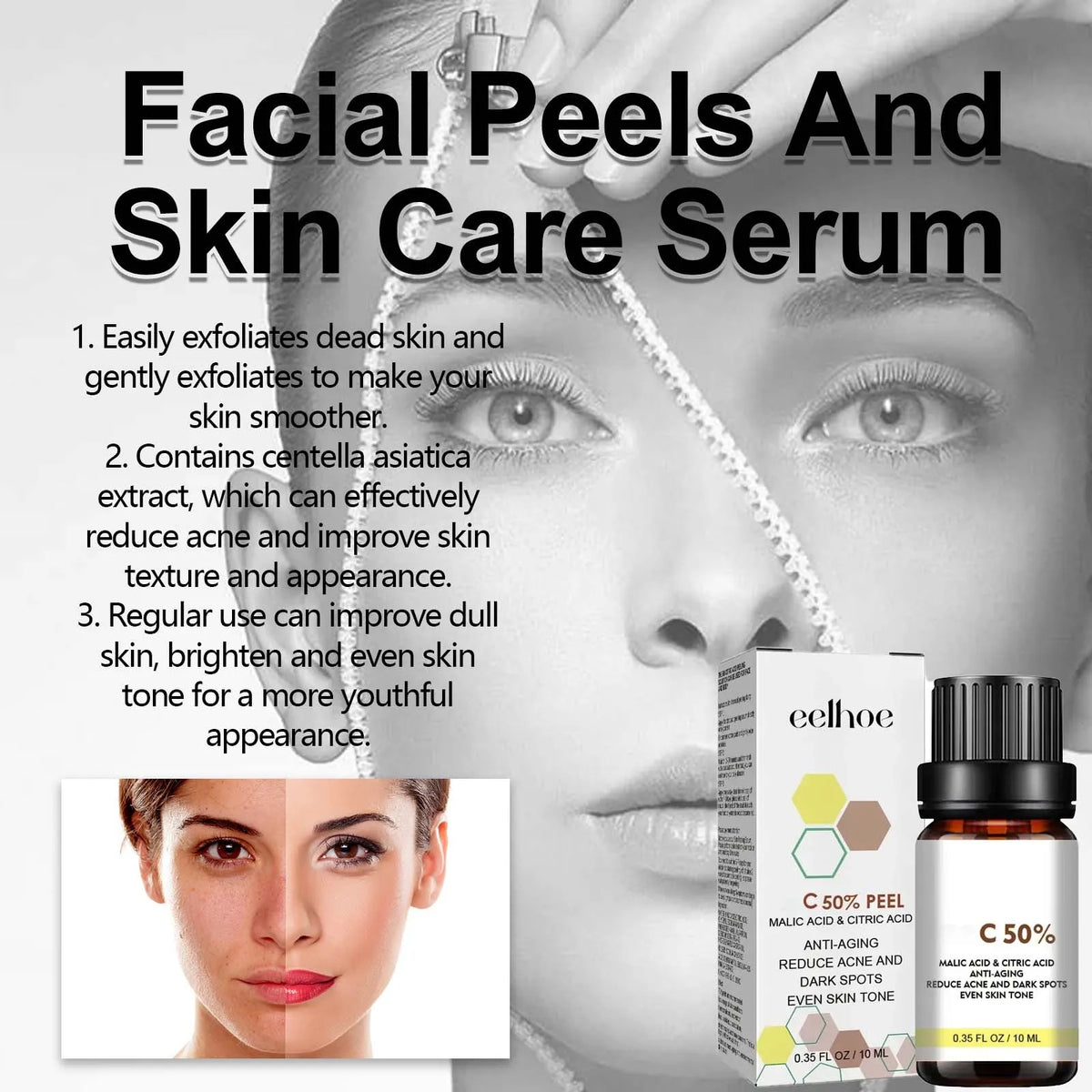 7ht With Malic Acid Citric Acid For Face Facial Peel 50% Peeling Serum Peeling Serum Chemical Peel Whitening Nourishing Essence