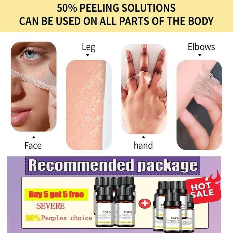 7ht With Malic Acid Citric Acid For Face Facial Peel 50% Peeling Serum Peeling Serum Chemical Peel Whitening Nourishing Essence